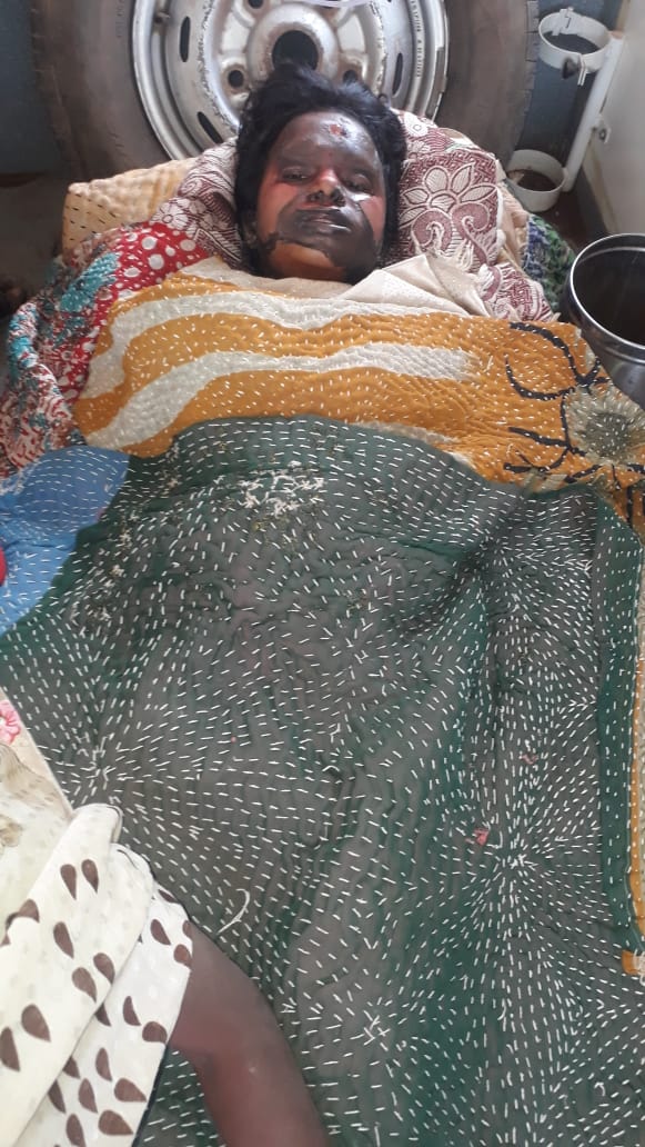 रीवा मऊगंज :बड़ी खवर- महिला प्रभा केवट ने लगाई आग 